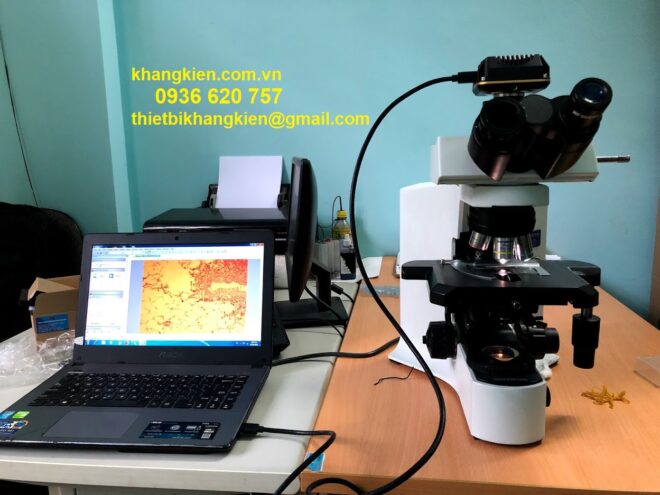 Nên chọn camera nào cho kính hiển vi ba mắt - 0936 620 757
